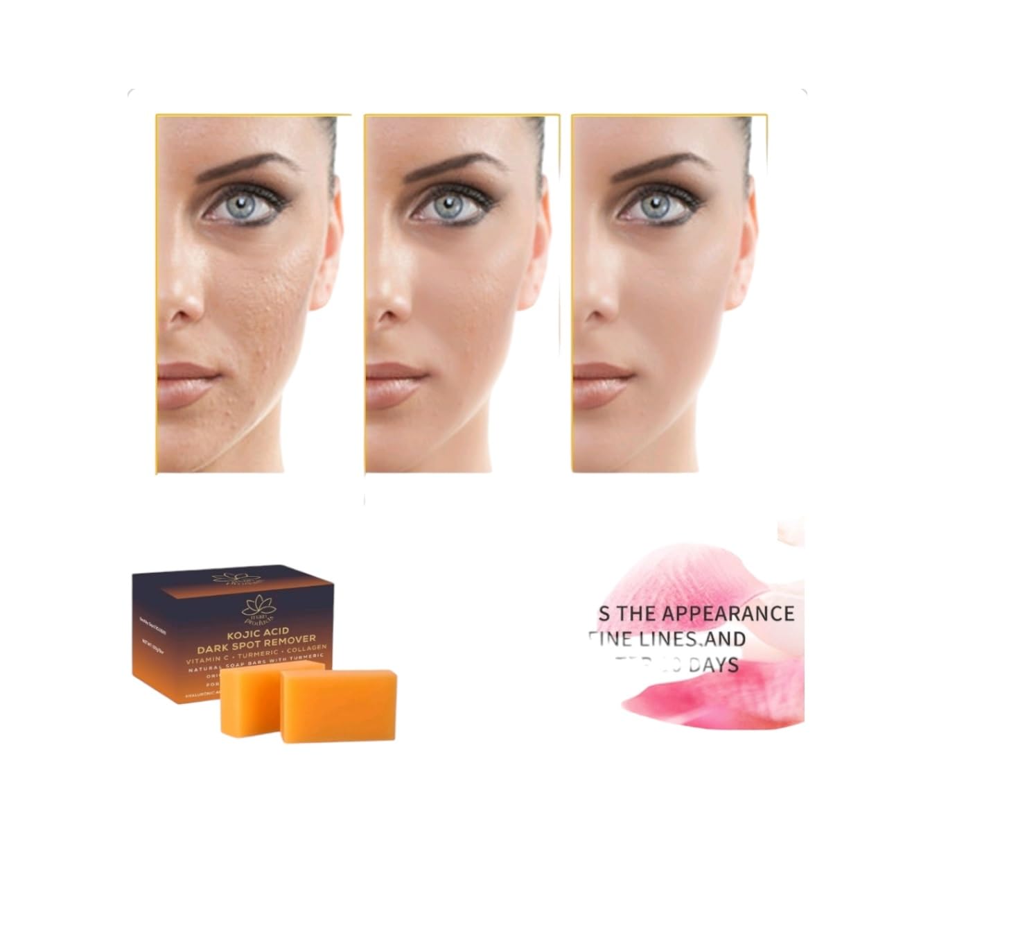 Kojic Acid Dark Spot Remover Soap Bars with Vitamin C, Retinol, Collagen, Turmeric, Original Japanese Complex infused with Hyaluronic Acid, Vitamin E, Shea Butter - Image 8